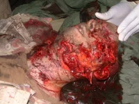 image01.head.iraq.webp