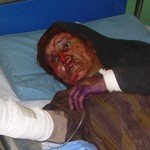 thumb_bala_baluk_wounded6.jpg