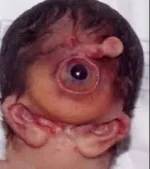 mutant.webp