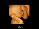 3d-Fetal-Ultrasound.jpg