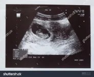 3 month fetus.webp