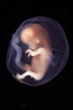 10-week-old-fetus_12-week-pregnancy.webp