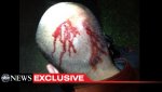 George-Zimmerman-Head-Injury1.jpg