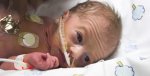 Premature-baby-infant-icu-hospital-shutterstock_3224706-shutterstock.jpg