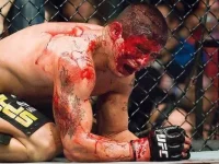 UFC_blood.webp