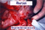 abortionposter3.jpg