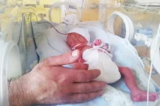 239026-2000x1332-preemie-baby-in-incubator.webp