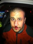 zimmerman-bloodied-e1354569582845.jpg