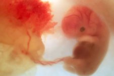 Fetal-Development-at-8-Weeks-610x406-3325790835.jpg