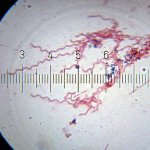 20100905_211652_Spirochetes.jpg