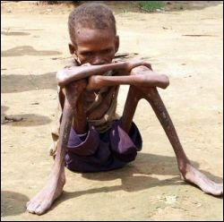 third-world-starvation.jpg