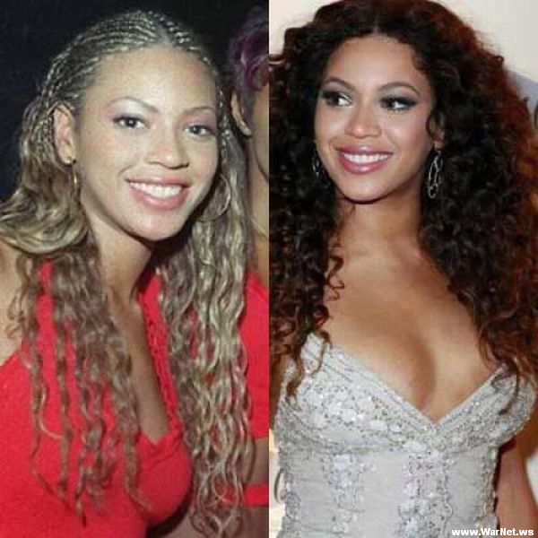 Beyonce-Breast-Implant.jpg