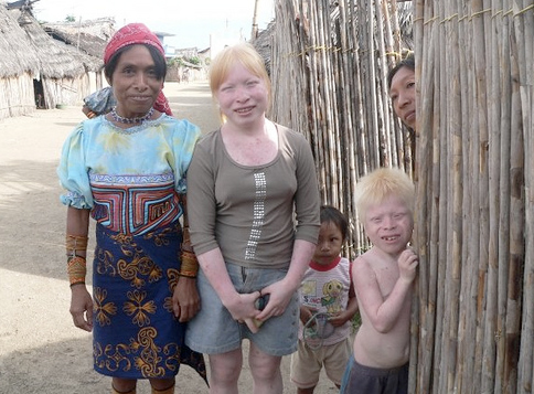 kuna-albino-panama.jpg